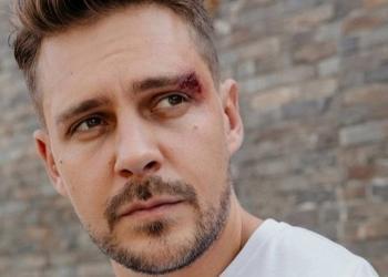 Miloš Biković odbio ulogu u stranoj seriji